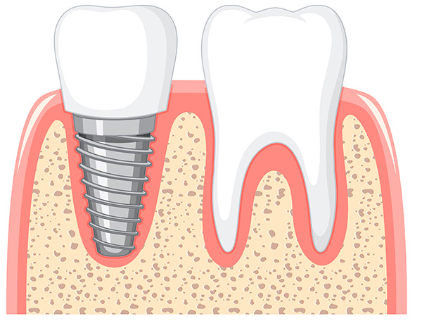 Dentálna hygiena